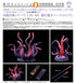 "Sushing Articulated Base Series" Articulated Base Series UBC-404 Entangling Tentacle Parts (Long)